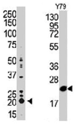 PEBP1 Rabbit anti-Human, Mouse, Polyclonal Antibody, Abnova 400 &mu;L | Buy Online | Abnova Corporation | Fisher Scientific