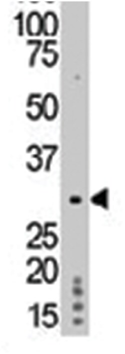 TP53RK, Rabbit, Polyclonal Antibody, Abnova 400 &mu;L | Buy Online | Abnova Corporation | Fisher Scientific