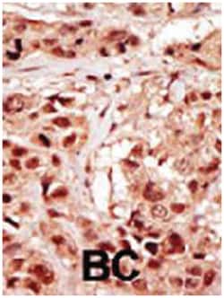 TP53RK, Rabbit, Polyclonal Antibody, Abnova 400 &mu;L | Buy Online | Abnova Corporation | Fisher Scientific
