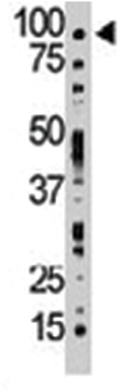 TLK1 Rabbit anti-Human, Polyclonal Antibody, Abnova 400&mu;L; Unlabeled:Antibodies,