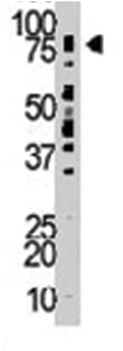 TLK2, Rabbit, Polyclonal Antibody, Abnova 400&mu;L; Unlabeled:Antibodies,