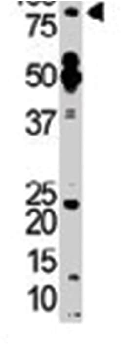 TTK, Rabbit, Polyclonal Antibody, Abnova 400&mu;L; Unlabeled:Antibodies,