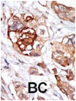 TTK, Rabbit, Polyclonal Antibody, Abnova 400&mu;L; Unlabeled:Antibodies,