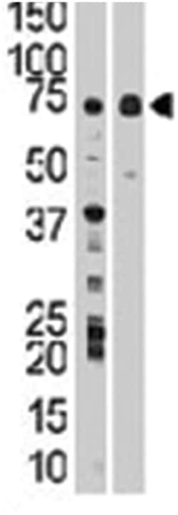 WEE1 Rabbit anti-Human, Mouse, Polyclonal Antibody, Abnova 400 &mu;L | Buy Online | Abnova Corporation | Fisher Scientific