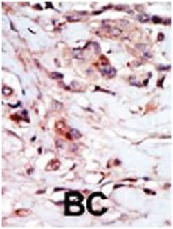 NPR1, Rabbit, Polyclonal Antibody, Abnova 400&mu;L; Unlabeled:Antibodies,