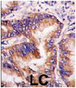 EIF2AK1 Rabbit anti-Human, Polyclonal Antibody, Abnova 400 &mu;L | Buy Online | Abnova Corporation | Fisher Scientific