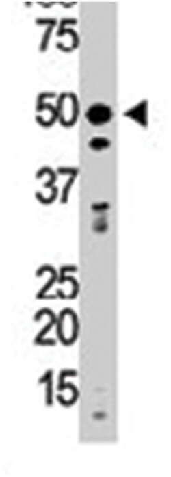 GSK3B Rabbit anti-Human, Polyclonal Antibody, Abnova 400&mu;L; Unlabeled:Antibodies,