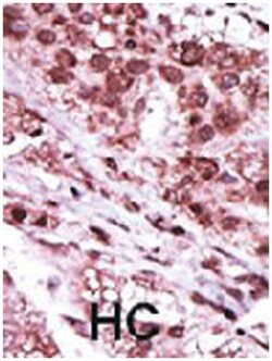 GSK3B Rabbit anti-Human, Polyclonal Antibody, Abnova 400&mu;L; Unlabeled:Antibodies,