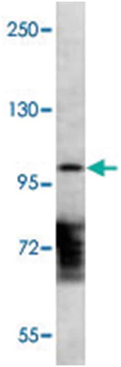 DGKQ Rabbit anti-Human, Polyclonal Antibody, Abnova 400 &mu;L | Buy Online | Abnova Corporation | Fisher Scientific