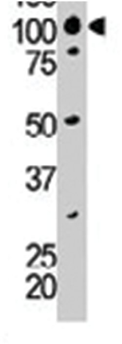 DGKI, Rabbit, Polyclonal Antibody, Abnova 400 &mu;L | Buy Online | Abnova Corporation | Fisher Scientific