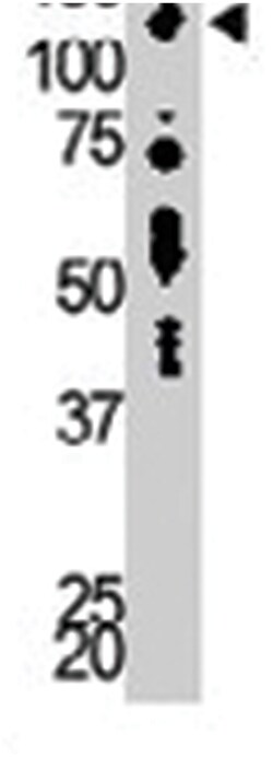 DGKD Rabbit anti-Human, Mouse, Polyclonal Antibody, Abnova 400&mu;L; Unlabeled:Antibodies,