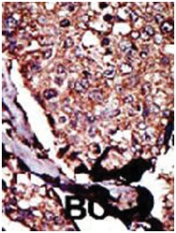 DGKB, Rabbit, Polyclonal Antibody, Abnova 400&mu;L; Unlabeled:Antibodies,