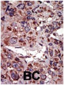 DGKA, Rabbit, Polyclonal Antibody, Abnova 400 &mu;L | Buy Online | Abnova Corporation | Fisher Scientific