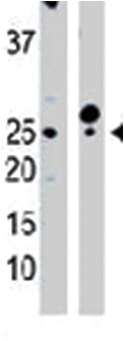 CMPK1 Rabbit anti-Human, Mouse, Polyclonal Antibody, Abnova 400 &mu;L | Buy Online | Abnova Corporation | Fisher Scientific