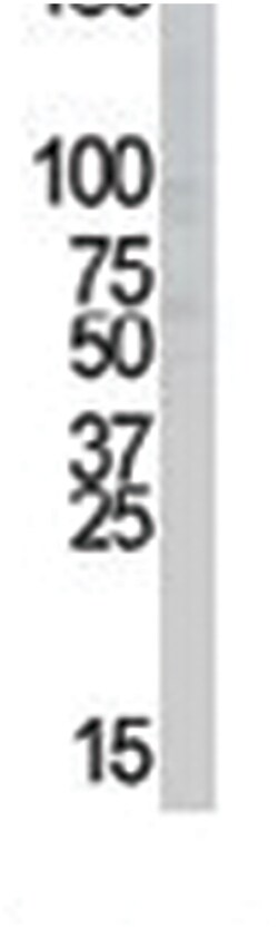 INSR Rabbit anti-Human, Polyclonal Antibody, Abnova 400 &mu;L | Buy Online | Abnova Corporation | Fisher Scientific