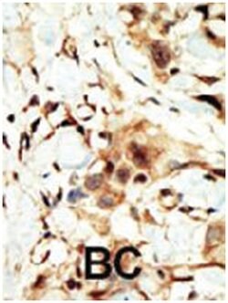 INSR Rabbit anti-Human, Polyclonal Antibody, Abnova 400 &mu;L | Buy Online | Abnova Corporation | Fisher Scientific