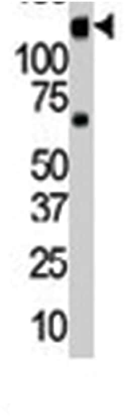 INSRR Rabbit anti-Human, Mouse, Polyclonal Antibody, Abnova 400 &mu;L | Buy Online | Abnova Corporation | Fisher Scientific