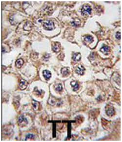 INSRR Rabbit anti-Human, Mouse, Polyclonal Antibody, Abnova 400 &mu;L | Buy Online | Abnova Corporation | Fisher Scientific
