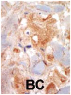 KIT Rabbit anti-Human, Monkey, Polyclonal Antibody, Abnova 400&mu;L; Unlabeled:Antikroppar