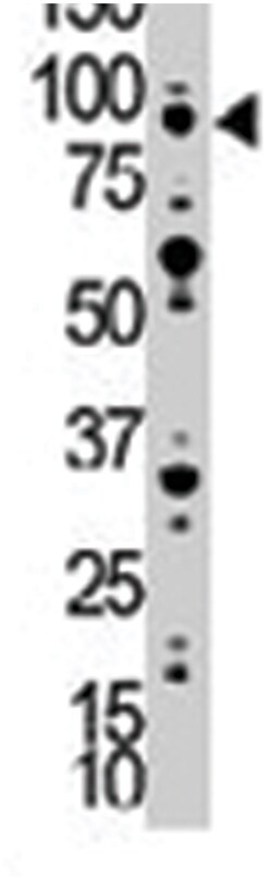 MUSK Rabbit anti-Human, Polyclonal Antibody, Abnova 400&mu;L; Unlabeled:Anticuerpos