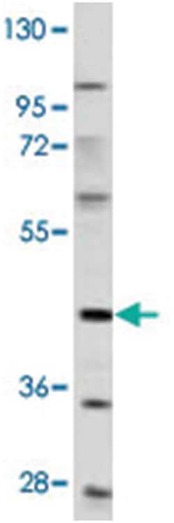PDGFRL, Rabbit, Polyclonal Antibody, Abnova 400 &mu;L | Buy Online | Abnova Corporation | Fisher Scientific