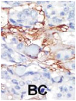 PDGFRL, Rabbit, Polyclonal Antibody, Abnova 400 &mu;L | Buy Online | Abnova Corporation | Fisher Scientific