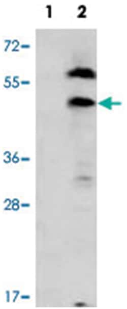 PDGFRL, Rabbit, Polyclonal Antibody, Abnova 400 &mu;L | Buy Online | Abnova Corporation | Fisher Scientific