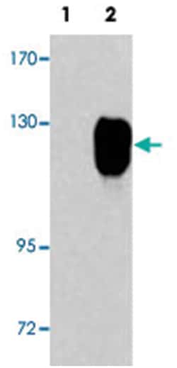 ROR1 Rabbit anti-Human, Polyclonal Antibody, Abnova 400 &mu;L | Buy Online | Abnova Corporation | Fisher Scientific