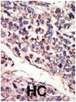 NTRK3 Rabbit anti-Human, Polyclonal Antibody, Abnova 400 &mu;L | Buy Online | Abnova Corporation | Fisher Scientific