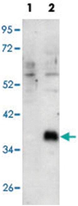 DOK4, Rabbit, Polyclonal Antibody, Abnova 400&mu;L; Unlabeled:Antibodies,