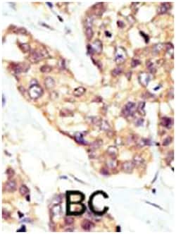DOK5 Rabbit anti-Human, Mouse, Polyclonal Antibody, Abnova 400 &mu;L | Buy Online | Abnova Corporation | Fisher Scientific