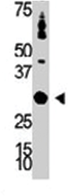 DOK5 Rabbit anti-Human, Mouse, Polyclonal Antibody, Abnova 400&mu;L; Unlabeled:Antibodies,