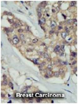 DOK5 Rabbit anti-Human, Mouse, Polyclonal Antibody, Abnova 400&mu;L; Unlabeled:Antibodies,