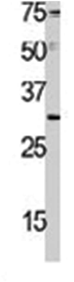ABL1 Rabbit anti-Human, Polyclonal Antibody, Abnova 400 &mu;L | Buy Online | Abnova Corporation | Fisher Scientific