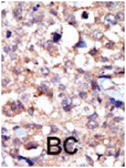 ABL1 Rabbit anti-Human, Polyclonal Antibody, Abnova 400 &mu;L | Buy Online | Abnova Corporation | Fisher Scientific