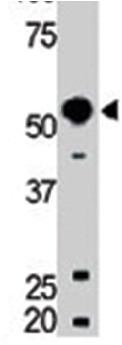 BLK Rabbit anti-Human, Mouse, Polyclonal Antibody, Abnova 400&mu;L; Unlabeled:Antibodies,