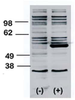 BLK Rabbit anti-Human, Mouse, Polyclonal Antibody, Abnova 400&mu;L; Unlabeled:Antibodies,