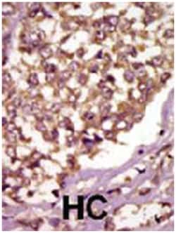 BMX Rabbit anti-Human, Mouse, Polyclonal Antibody, Abnova 400 &mu;L | Buy Online | Abnova Corporation | Fisher Scientific