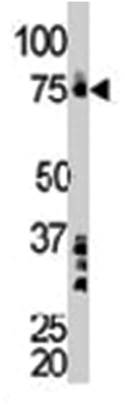 BTK Rabbit anti-Human, Polyclonal Antibody, Abnova 400 &mu;L | Buy Online | Abnova Corporation | Fisher Scientific