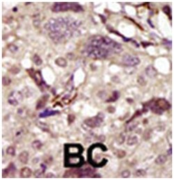 BTK Rabbit anti-Human, Polyclonal Antibody, Abnova 400 &mu;L | Buy Online | Abnova Corporation | Fisher Scientific
