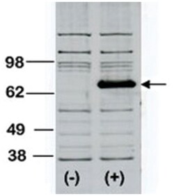 BTK Rabbit anti-Human, Polyclonal Antibody, Abnova 400 &mu;L | Buy Online | Abnova Corporation | Fisher Scientific