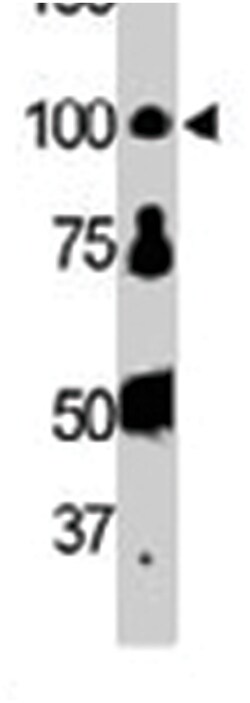 FER Rabbit anti-Human, Polyclonal Antibody, Abnova 400 &mu;L | Buy Online | Abnova Corporation | Fisher Scientific