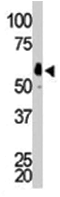 FGR Rabbit anti-Human, Polyclonal Antibody, Abnova 400 &mu;L | Buy Online | Abnova Corporation | Fisher Scientific