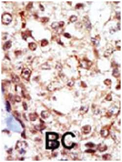 FGR Rabbit anti-Human, Polyclonal Antibody, Abnova 400 &mu;L | Buy Online | Abnova Corporation | Fisher Scientific