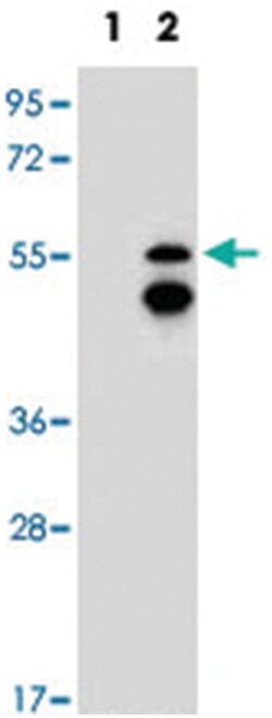FRK, Rabbit, Polyclonal Antibody, Abnova 400&mu;L; Unlabeled:Antibodies,