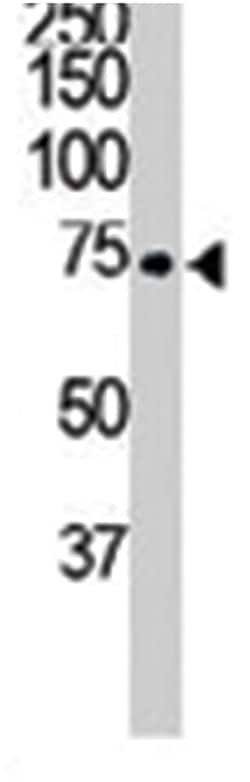 ITK, Rabbit, Polyclonal Antibody, Abnova 400 &mu;L | Buy Online | Abnova Corporation | Fisher Scientific