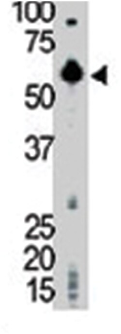 LCK Rabbit anti-Human, Mouse, Polyclonal Antibody, Abnova 400&mu;L; Unlabeled:Anticuerpos