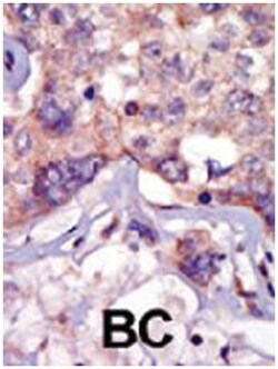 LCK Rabbit anti-Human, Mouse, Polyclonal Antibody, Abnova 400&mu;L; Unlabeled:Anticuerpos