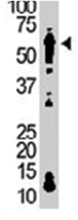 LYN Rabbit anti-Human, Mouse, Polyclonal Antibody, Abnova 400 &mu;L | Buy Online | Abnova Corporation | Fisher Scientific