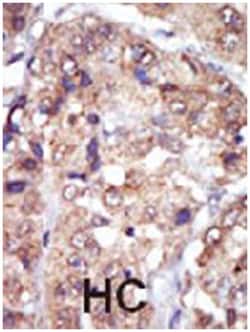 LYN Rabbit anti-Human, Mouse, Polyclonal Antibody, Abnova 400 &mu;L | Buy Online | Abnova Corporation | Fisher Scientific